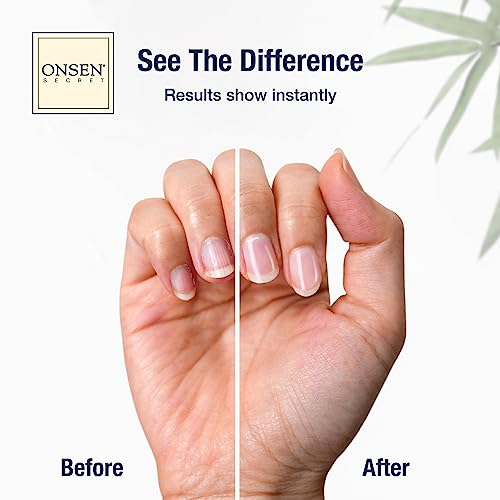 Onsen Secret Complete Nail Reboot Kit w/Cuticle Oil 10ml, Nail File 120/180 Grit Double Sided, A 3-Way Buffer Block & Cuticle Serum-15ml in Action | Super Value Pack - size: Complete Nail Reboot Kit