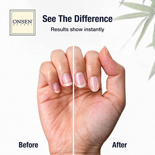 Onsen Secret Nail Care Kit - Includes Cuticle Oil 10ml, Japanese Nail Buffer and Shine Kit - Spa-Quality Manicure - Organic Ingredients - Long-Lasting Shine - Easy & Safe - 1pk - size: Essential Nail Reboot Kit (Oil)