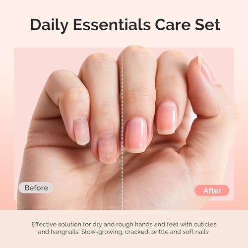 MelodySusie Cuticle Remover Kit,Cuticle Remover Cream and Oil 25ML | Cuticle Nipper,Trimmer Pusher,Nail File and Brush for Cuticle Softener & Moisturize Manicure Kit for Nail Care Rose - size: 7Pcs Rose
