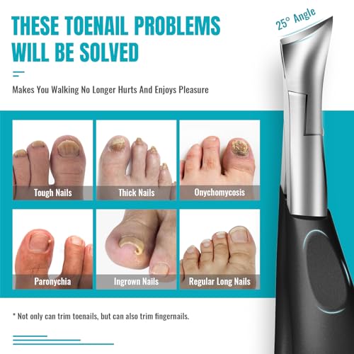 Toenail Clippers for Thick Nails for Seniors - Heavy Duty Toe Nail Clippers Kit with Long Handle for Men & Elderly with Inflexible Joints, Professional Nail Clippers Kit for Thickened Toenails (Black) - style: Creating Exquisite Nails - Black